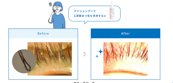 アイシャンプー